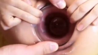 Xiu Yan Hong buries a glass in the vagina